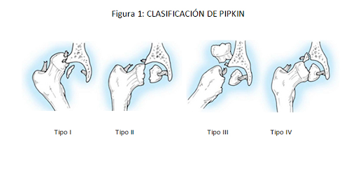 Luxación coxofemoral: Abordaje a través de la fisioterapia