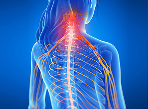 Manipulación vertebral y vendaje neuromuscular como tratamiento para la cervicalgia.