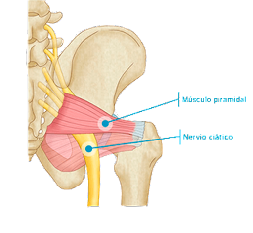 Tratamiento mediante la Fisioterapia para el Síndrome del Músculo Piramidal