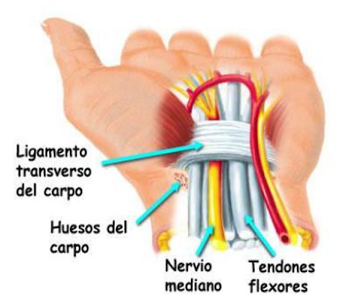 Síndrome del túnel carpiano y su tratamiento a través de la fisioterapia