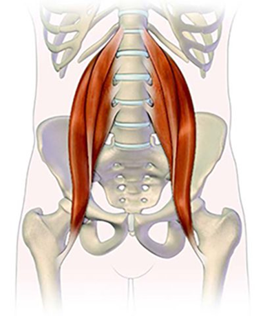 Tendinitis del psoas