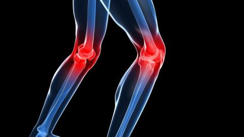 Artrosis de rodilla y su tratamiento mediante la fisioterapia Artrosis de rodilla y su tratamiento mediante la fisioterapia