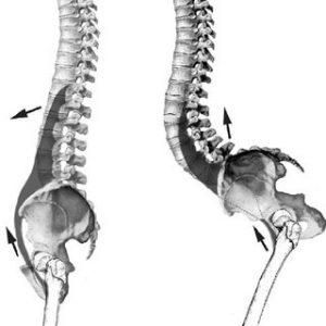 Hiperlordosis lumbar: Tratamiento a través de la fisioterapia Hiperlordosis lumbar: Tratamiento a través de la fisioterapia