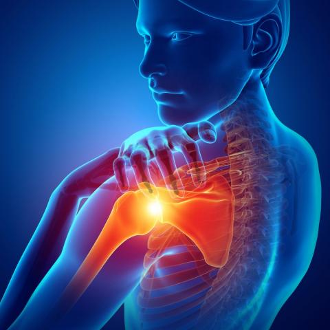 ¿Qué es la tendinitis del supraespinoso y cuál es su tratamiento? ¿Qué es la tendinitis del supraespinoso y cuál es su tratamiento?