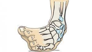 ¿Cómo puedes mejorar tú esguince de tobillo con la aplicación del vendaje neuromuscular? ¿Cómo puedes mejorar tú esguince de tobillo con la aplicación del vendaje neuromuscular?