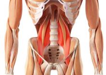 Tendinitis del psoas